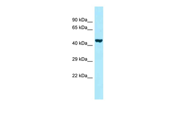 PROKR2 Rabbit Polyclonal Antibody