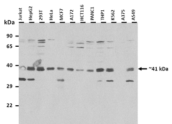 SUMF1 Rabbit Polyclonal Antibody