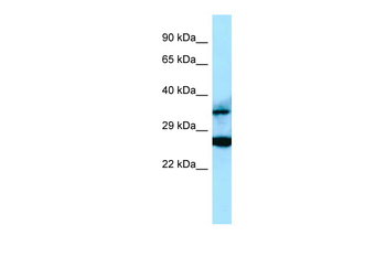 RASSF2 Rabbit Polyclonal Antibody