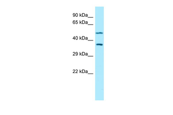 AKR1A1 Rabbit Polyclonal Antibody