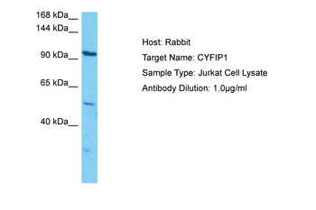 CYFIP1 Rabbit Polyclonal Antibody