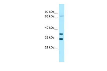 SORT1 Rabbit Polyclonal Antibody
