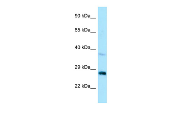 CTDSP1 Rabbit Polyclonal Antibody