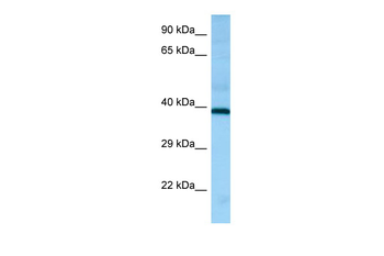 HRH2 Rabbit Polyclonal Antibody