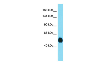 Tmprss3 Rabbit Polyclonal Antibody