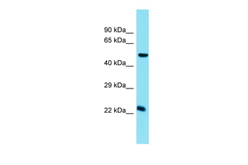 Chmp5 Rabbit Polyclonal Antibody