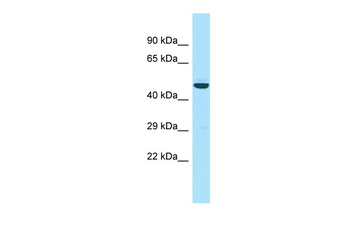 APOL3 Rabbit Polyclonal Antibody