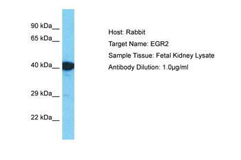 EGR2 Rabbit Polyclonal Antibody