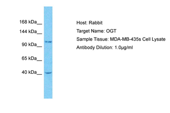 OGT Rabbit Polyclonal Antibody