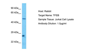 TFEB Rabbit Polyclonal Antibody