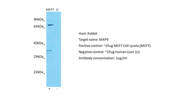 MAP9 Rabbit Polyclonal Antibody
