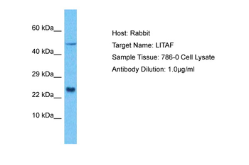 LITAF Rabbit Polyclonal Antibody