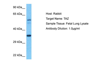 TAZ Rabbit Polyclonal Antibody