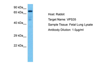 VPS35 Rabbit Polyclonal Antibody