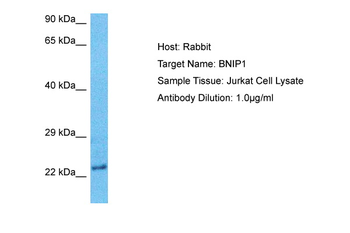 BNIP1 Rabbit Polyclonal Antibody