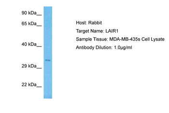LAIR1 Rabbit Polyclonal Antibody