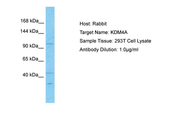 KDM4A Rabbit Polyclonal Antibody