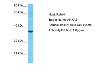 ANXA2 Rabbit Polyclonal Antibody