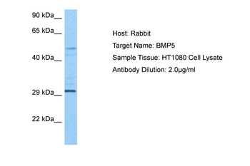 BMP5 Rabbit Polyclonal Antibody