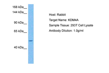KDM4A Rabbit Polyclonal Antibody