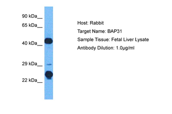BCAP31 Rabbit Polyclonal Antibody