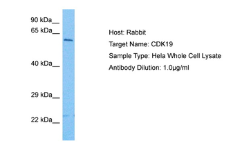 CDK19 Rabbit Polyclonal Antibody
