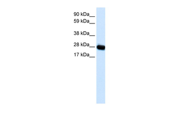 CAV3 Rabbit Polyclonal Antibody