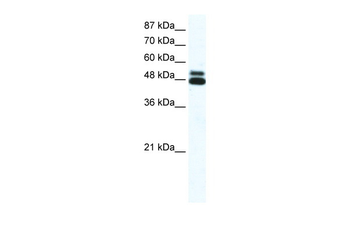CHRNB2 Rabbit Polyclonal Antibody