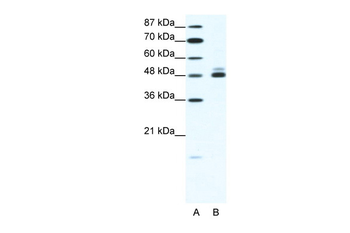 CHRNB2 Rabbit Polyclonal Antibody