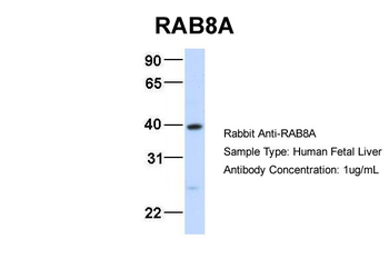 RAB8A Rabbit Polyclonal Antibody