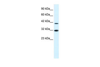 IRF2 Rabbit Polyclonal Antibody