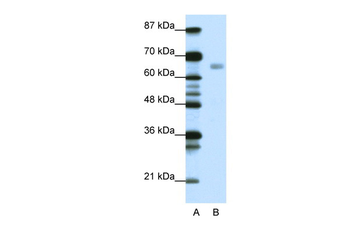 HSF1 Rabbit Polyclonal Antibody