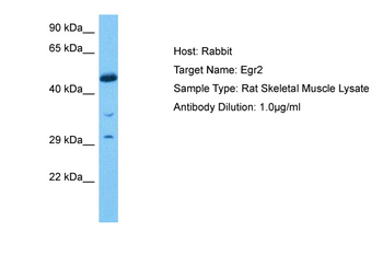 EGR2 Rabbit Polyclonal Antibody