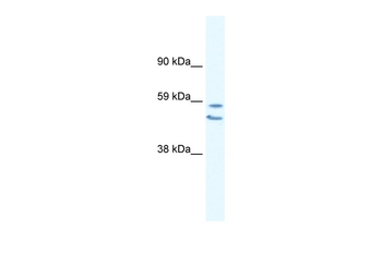 EGR2 Rabbit Polyclonal Antibody