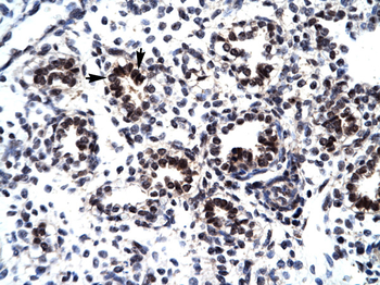GABPB2 Rabbit Polyclonal Antibody