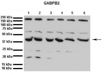 GABPB2 Rabbit Polyclonal Antibody