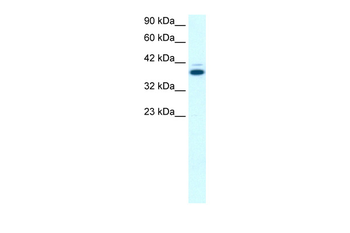 GABPB2 Rabbit Polyclonal Antibody