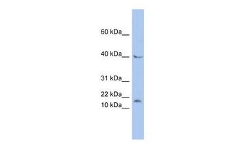 MAX Rabbit Polyclonal Antibody