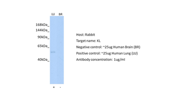 KL Rabbit Polyclonal Antibody