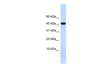 AGT Rabbit Polyclonal Antibody