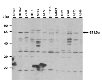 TGFBR2 Rabbit Polyclonal Antibody