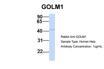 GOLM1 Rabbit Polyclonal Antibody