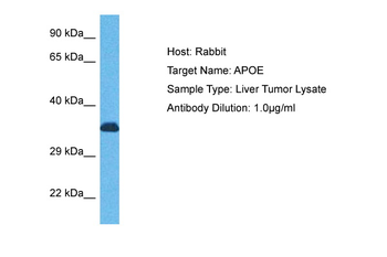 APOE Rabbit Polyclonal Antibody