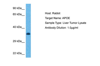 APOE Rabbit Polyclonal Antibody