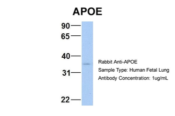 APOE Rabbit Polyclonal Antibody