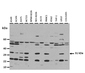 IL1A Rabbit Polyclonal Antibody