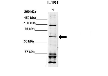 IL1R1 Rabbit Polyclonal Antibody