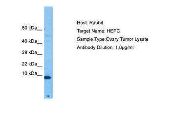 HAMP Rabbit Polyclonal Antibody
