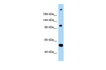 L1CAM Rabbit Polyclonal Antibody