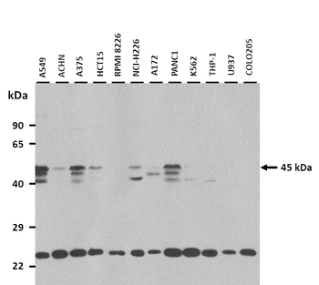 NEU1 Rabbit Polyclonal Antibody